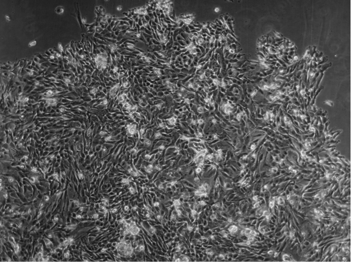 Primary cancer cells from a squamous cell carcinoma