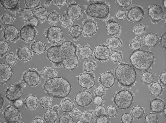 Primary cancer cells from a low-grade small cell lung cancer