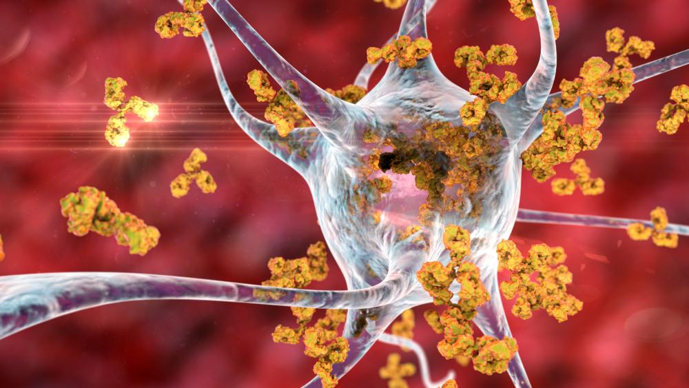 Designing models for autoimmune research