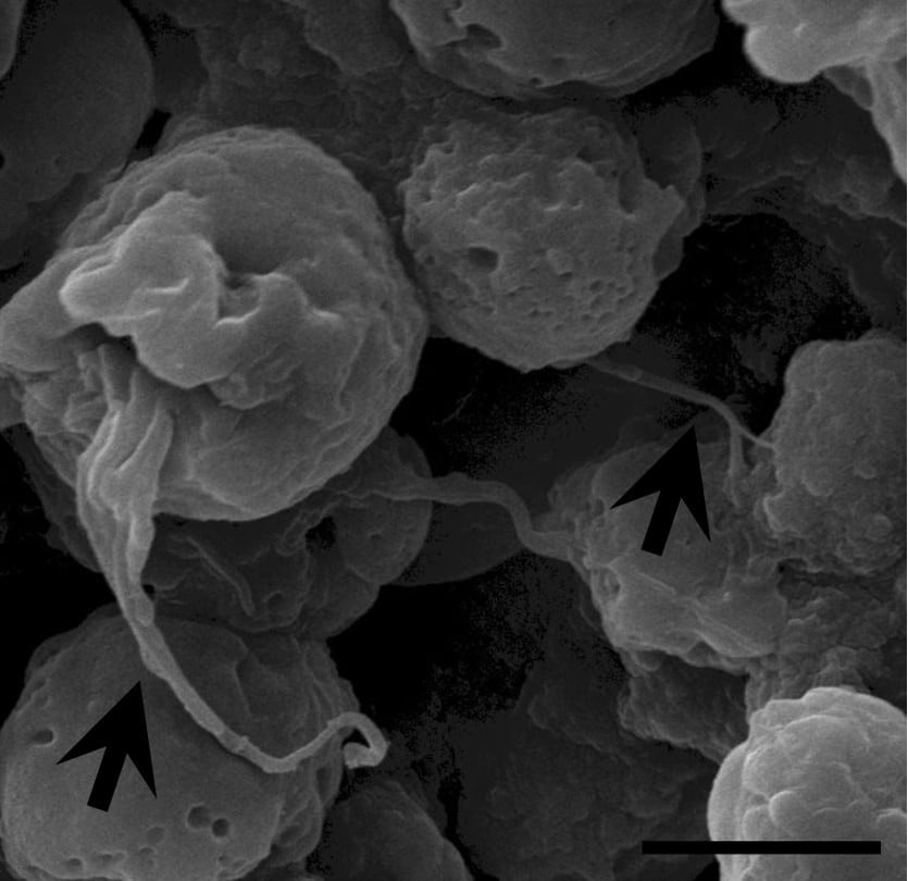Spheroid Cancer 3D Cell Culture