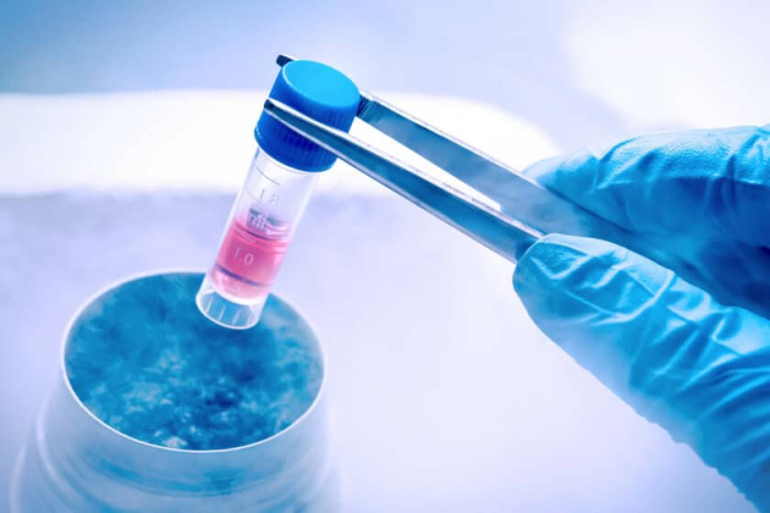Optimizing cryopreservation: Serum-free cell freezing medium