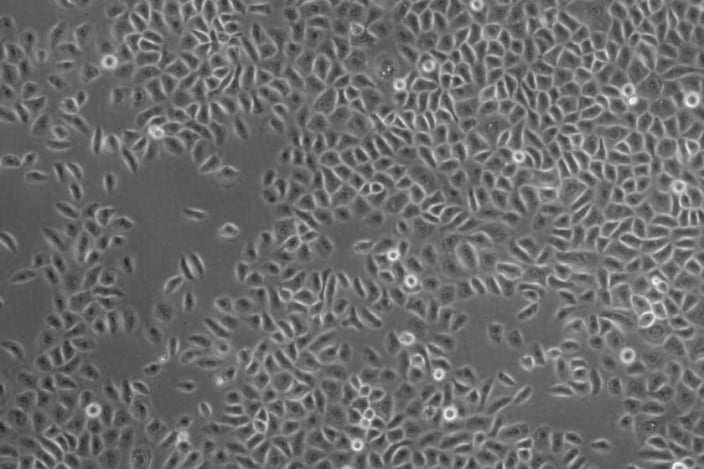 Featured image for Upgrade of our keratinocyte cell culture portfolio