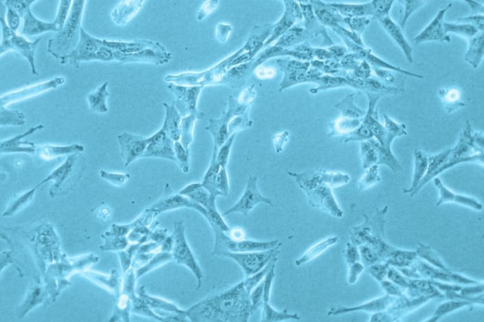 Featured image for More robust and advanced Pericyte Growth Medium 2 for your lab