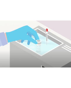 Thawing frozen cells – detailed protocol for human primary cells