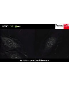 Cells in Action: Double mitosis of Human Umbilical Vein Endothelial Cells (HUVECs)