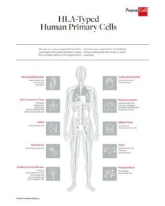 HLA-typed human primary cells