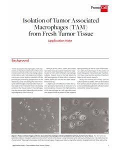 Isolation of Tumor Associated Macrophages (TAM) from Fresh Tumor Tissue
