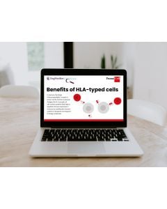 Benefits of HLA-typed cells