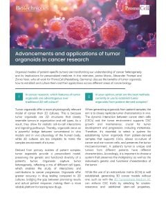 Tumor organoids - expert interview