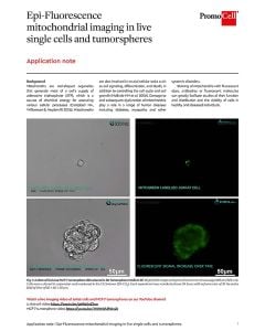 Epi-Fluorescence mitochondrial imaging in live single cells and tumorspheres