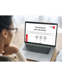 Mesenchymal stem cell culture 