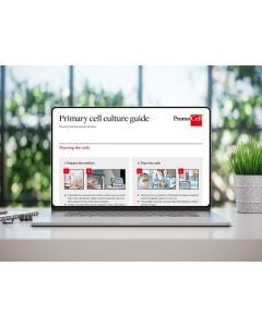 Primary cell culture guide: Thawing, freezing, and subcultivation