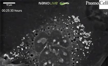 Cells in Action: Human Primary Keratinocytes at the stratum granulosum product image