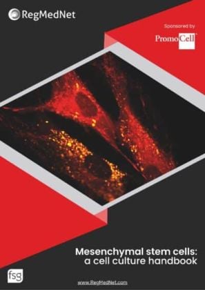 Mesenchymal stem cells: a cell culture handbook product image