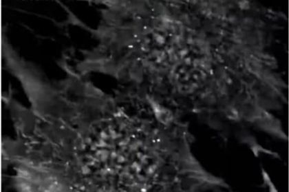 Cells in Action: Mitosis in Human Mesenchymal Stem Cells (MSCs) product image