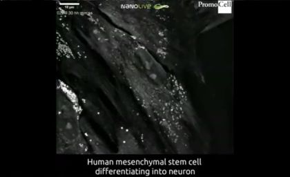 Cells in action: Differentiation of human mesenchymal stem cells into neurons product image