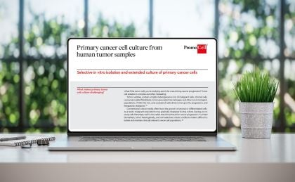 Primary cancer cell culture from human tumor samples product image
