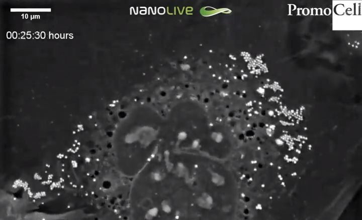 Cells in Action: Human Primary Keratinocytes at the stratum granulosum product image