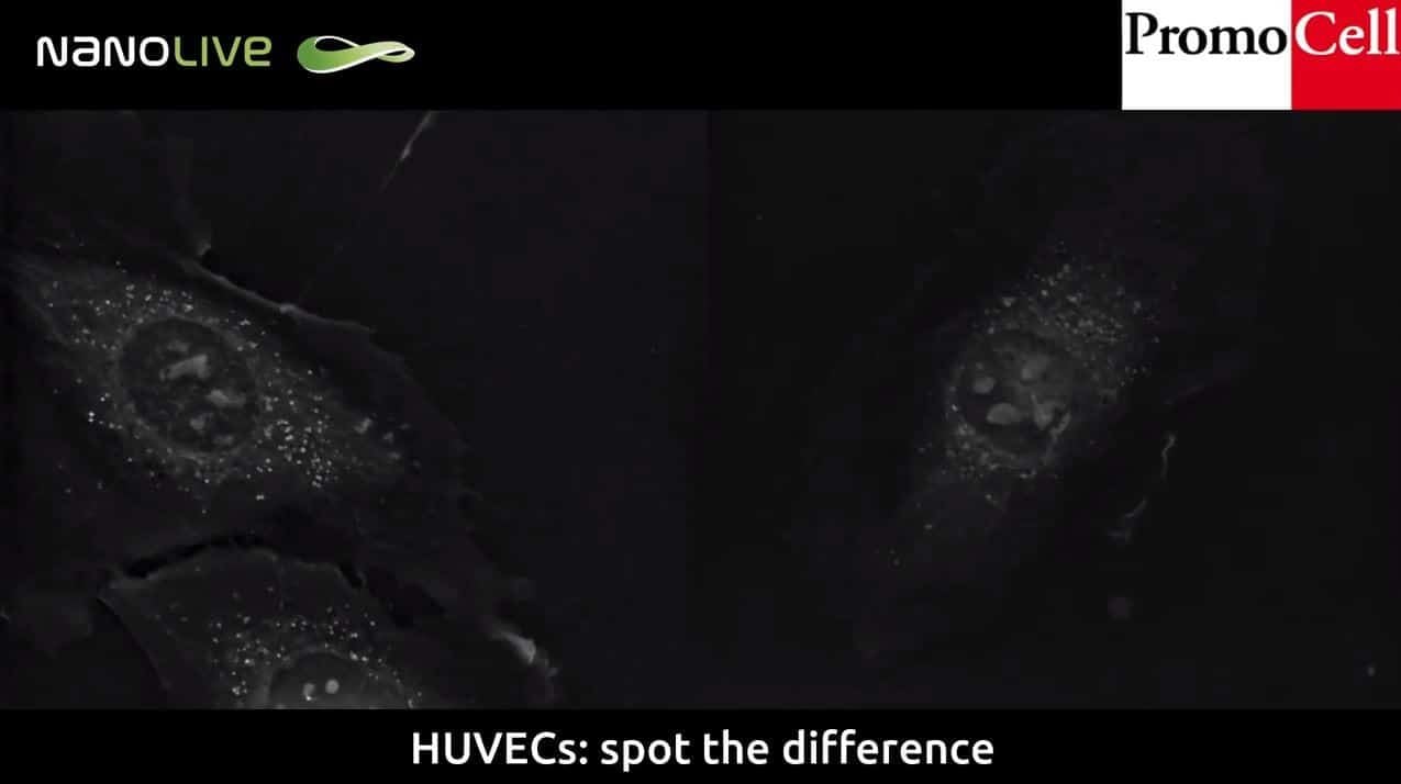 Cells in Action: Double mitosis of Human Umbilical Vein Endothelial Cells (HUVECs) product image