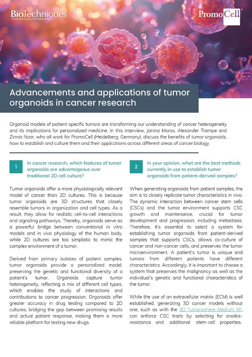 Tumor organoids - expert interview product image