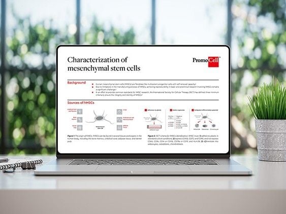 Laptop showing a poster 