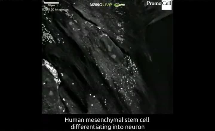 Cells in action: Differentiation of human mesenchymal stem cells into neurons product image