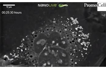 Cells in Action: Human Primary Keratinocytes at the stratum granulosum