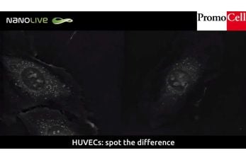 Cells in Action: Double mitosis of Human Umbilical Vein Endothelial Cells (HUVECs)