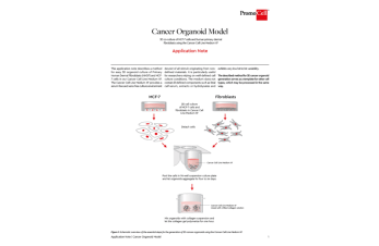 Cancer organoid model