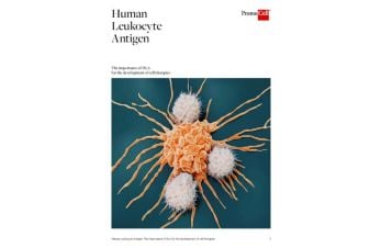 The importance of HLA for the development of cell therapies