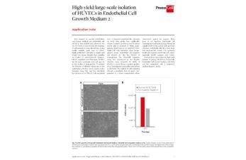 High-yield isolation of HUVECs in Endothelial Cell Growth Medium 2