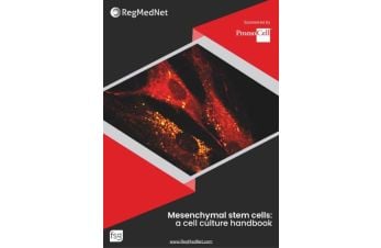 Mesenchymal stem cells: a cell culture handbook