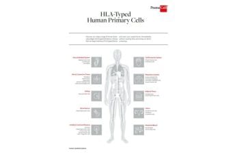HLA-typed human primary cells