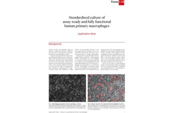Standardized culture of assay-ready and fully functional human primary macrophages