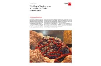 The role of angiogenesis in cellular processes and disorders