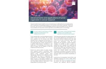 Tumor organoids - expert interview