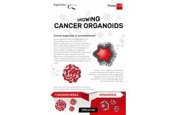 Growing cancer organoids
