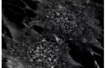 Cells in Action: Mitosis in Human Mesenchymal Stem Cells (MSCs)