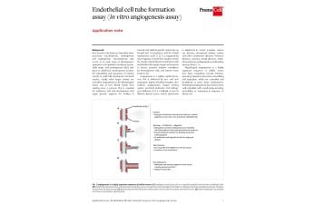 Endothelial cell tube formation assay (in vitro angiogenesis assay)