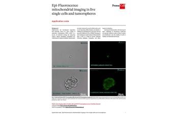 Epi-Fluorescence mitochondrial imaging in live single cells and tumorspheres