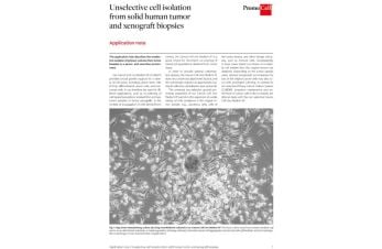 Unselective cell isolation from solid human tumor and xenograft biopsies
