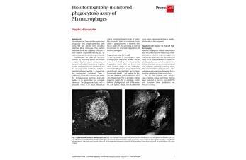 Holotomography-monitored phagocytosis assay of M1 macrophages