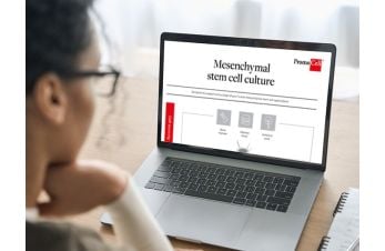 Mesenchymal stem cell culture 