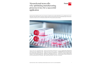Mesenchymal stem cells: why optimizing manufacturing processes is key for a successful application