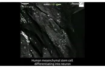 Cells in action: Differentiation of human mesenchymal stem cells into neurons