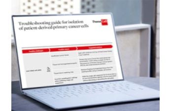 Troubleshooting guide for isolation of patient-derived PCCS