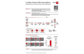 3D tumorsphere cell culture model