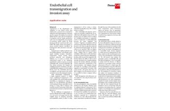 Endothelial cell transmigration and invasion assay