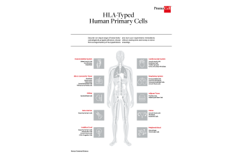 HLA-typed human primary cells