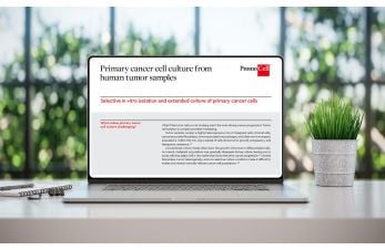 Primary cancer cell culture from human tumor samples